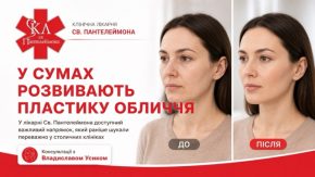 У лікарні Святого Пантелеймона в Сумах розвивають пластику обличчя: послуга, яку раніше шукали переважно у столичних клініках
